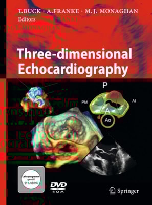 Three-dimensional Echocardiography