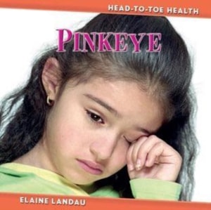 Pinkeye