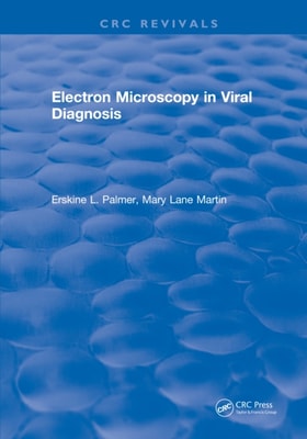 Electron Microscopy in Viral Diagnosis