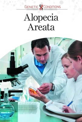 Alopecia Areata