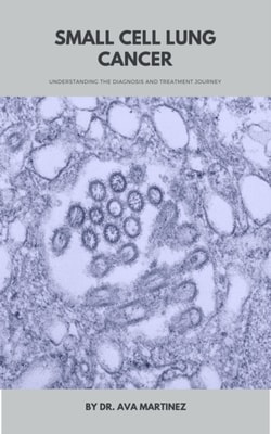 Small Cell Lung Cancer