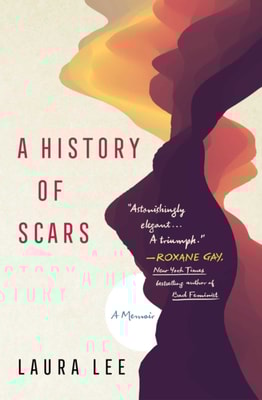 History of Scars