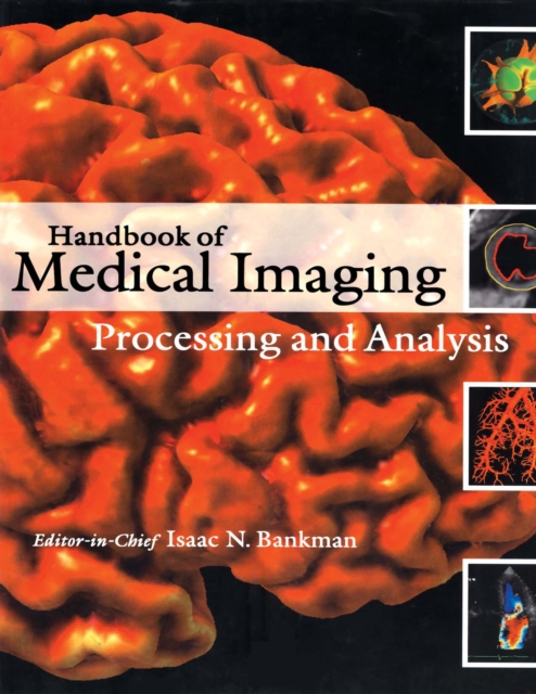 Handbook of Medical Imaging