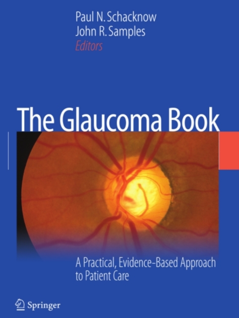 Glaucoma Book