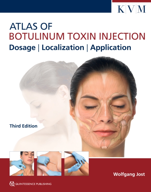 Atlas of Botulinum Toxin Injection