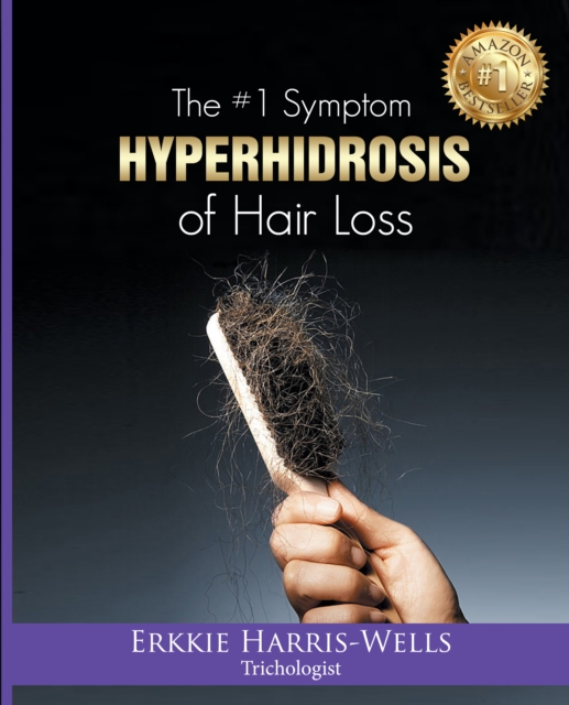 #1 Symptom of Hair Loss Hyperhidrosis