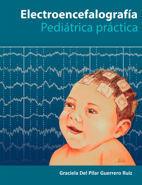 Electroencefalografía Pediatría Práctica