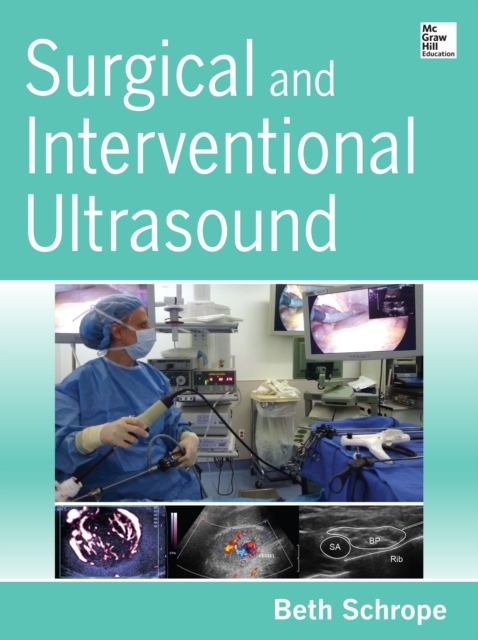 Surgical and Interventional Ultrasound
