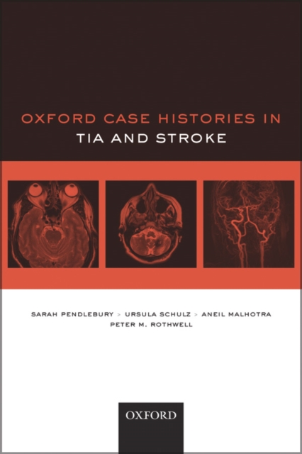 Oxford Case Histories in TIA and Stroke