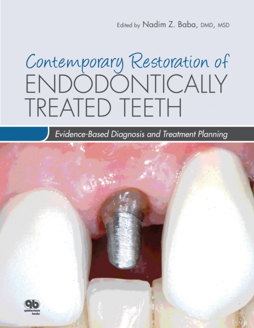 Complete Denture