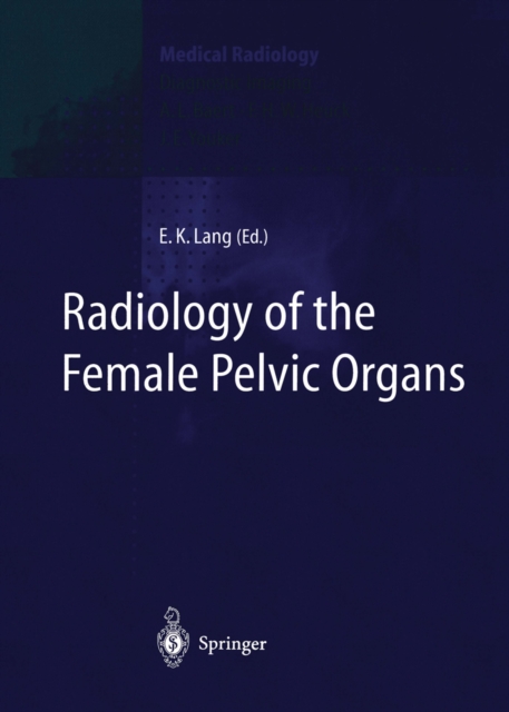Radiology of the Female Pelvic Organs