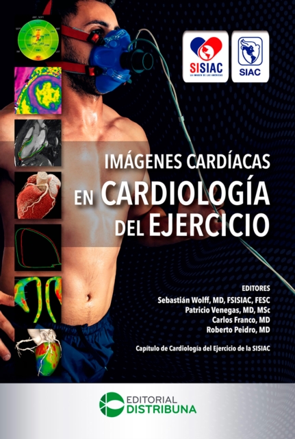 Imágenes Cardíacas en Cardiología del Ejercicio