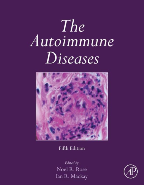 Autoimmune Diseases
