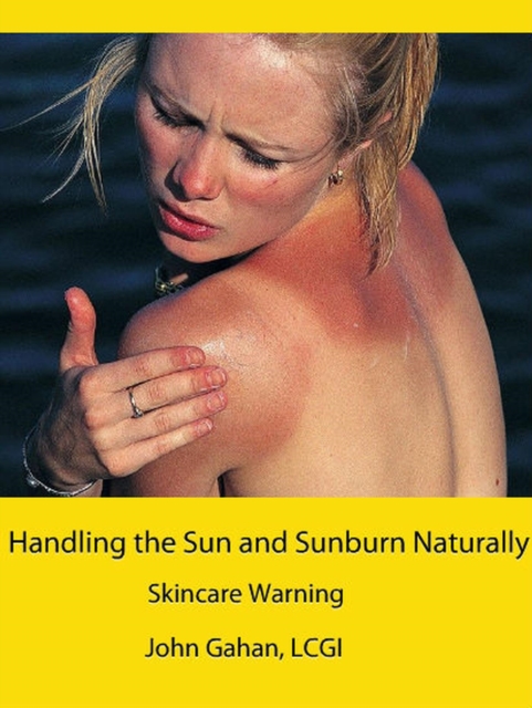 Handling the Sun and Sunburn Naturally:  Skincare Warning