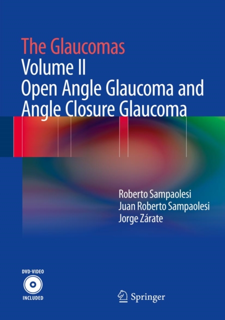 Glaucomas
