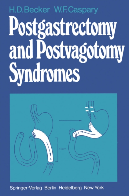 Postgastrectomy and Postvagotomy Syndromes