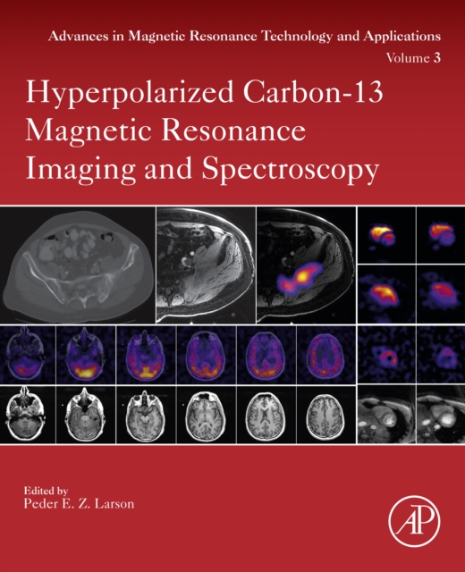 Hyperpolarized Carbon-13 Magnetic Resonance Imaging and Spectroscopy