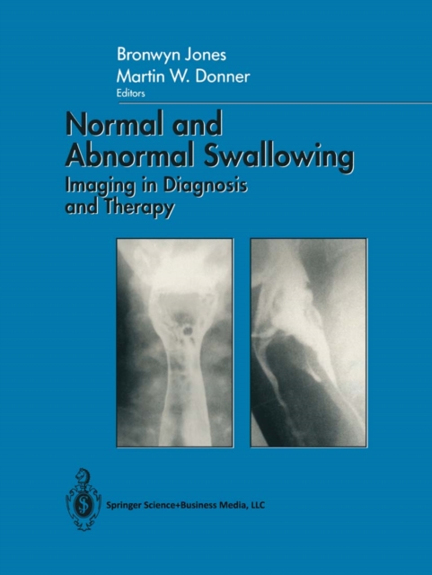 Normal and Abnormal Swallowing