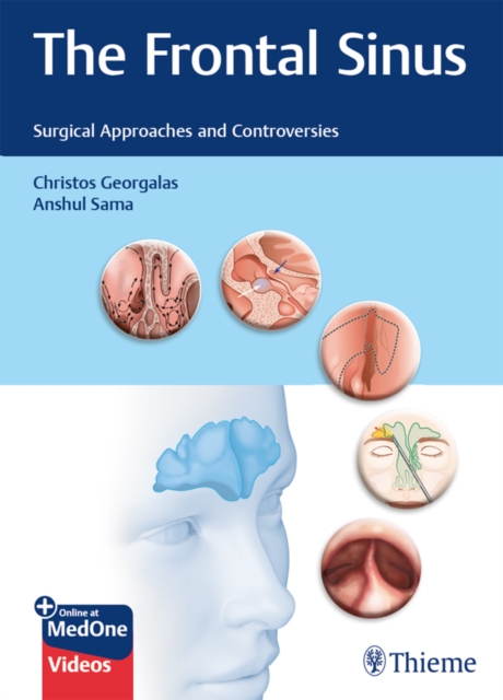 Frontal Sinus