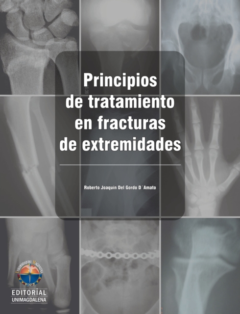 Principios de tratamiento en fracturas de extremidades