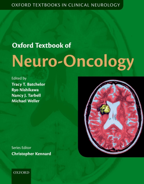 Oxford Textbook of Neuro-Oncology