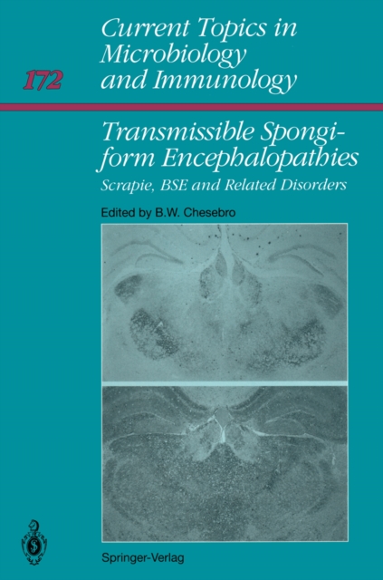 Transmissible Spongiform Encephalopathies: