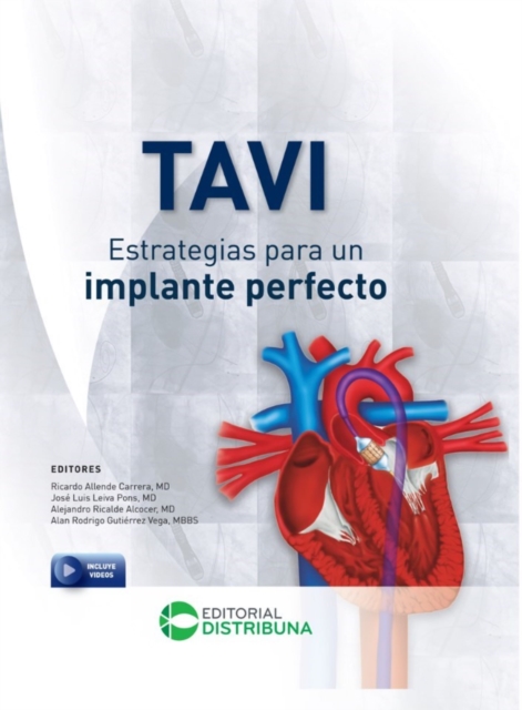 TAVI - Estrategias para un implante perfecto