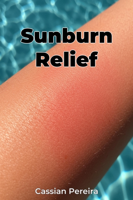 Sunburn Relief