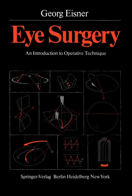 Eye Surgery