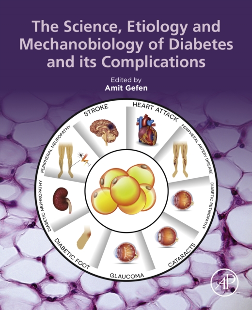 Science, Etiology and Mechanobiology of Diabetes and its Complications