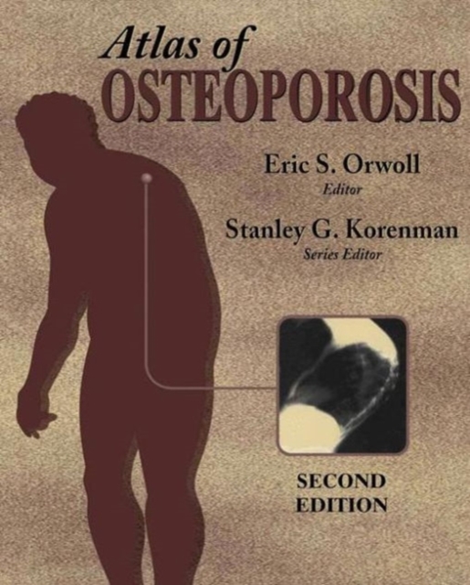 Atlas of Osteoporosis