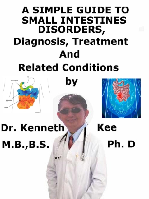 Simple Guide to Small Intestines Disorders, Diagnosis, Treatment and Related Conditions