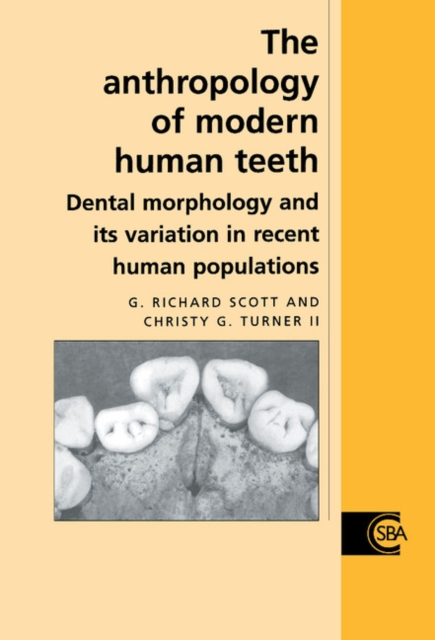 Anthropology of Modern Human Teeth