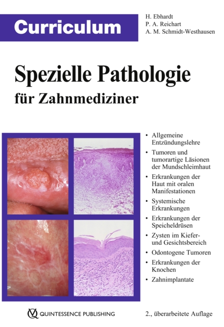 Curriculum Spezielle Pathologie für Zahnmediziner