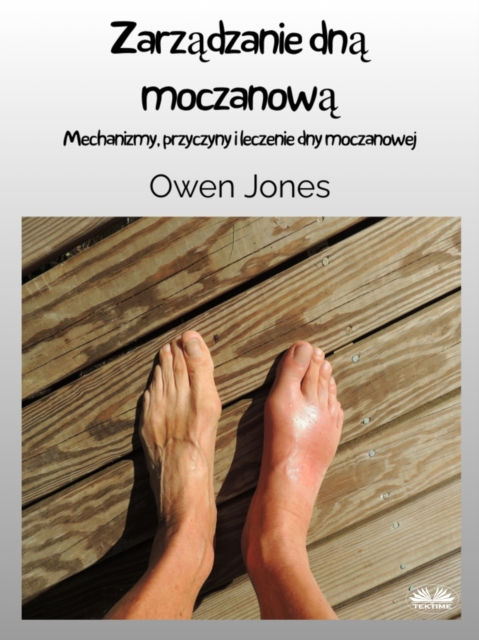 Zarządzanie Dną Moczanową