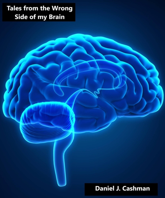 Tales from the Wrong Side of my Brain