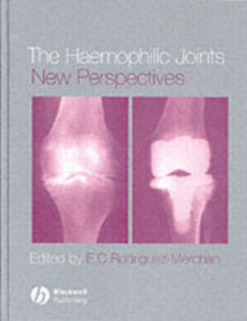 Haemophilic Joints