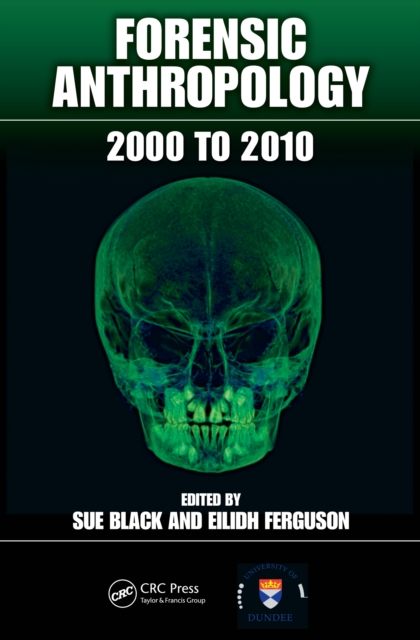 Forensic Anthropology