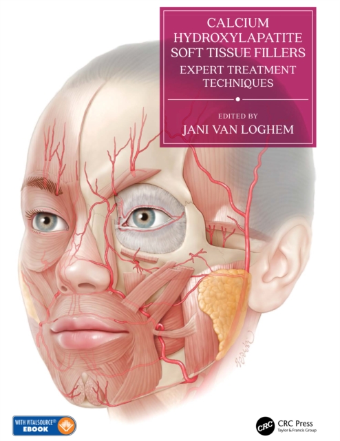 Calcium Hydroxylapatite Soft Tissue Fillers