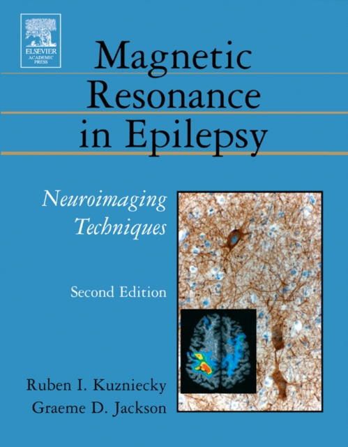 Magnetic Resonance in Epilepsy