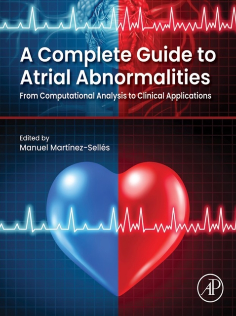 Complete Guide to Atrial Abnormalities