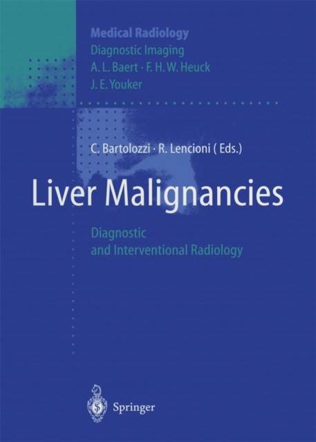 Liver Malignancies