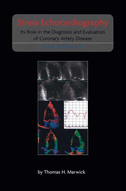 Stress Echocardiography
