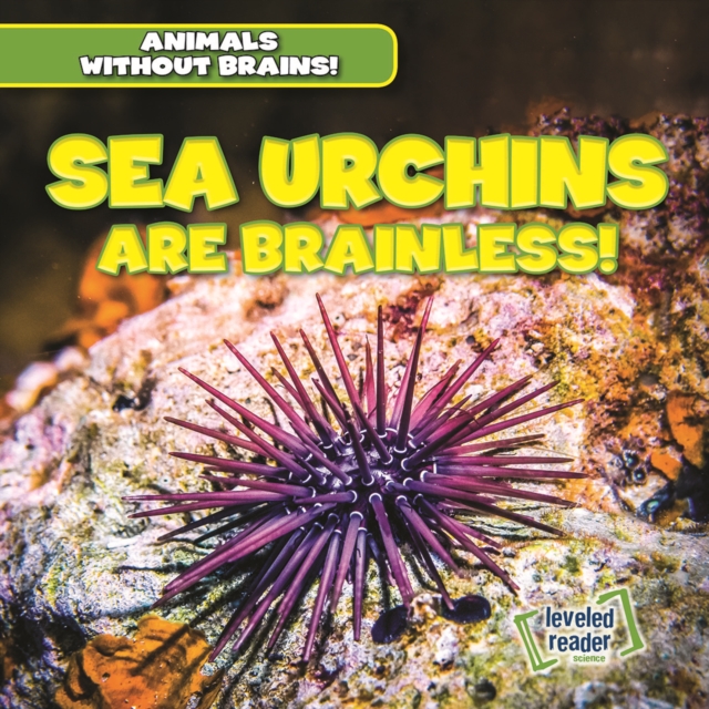 Sea Urchins Are Brainless!