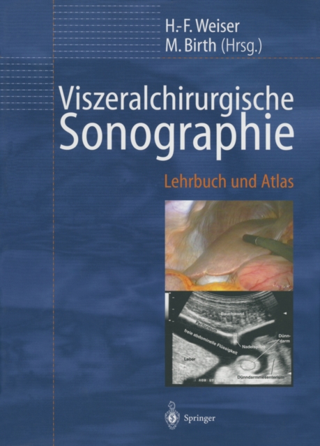 Viszeralchirurgische Sonographie