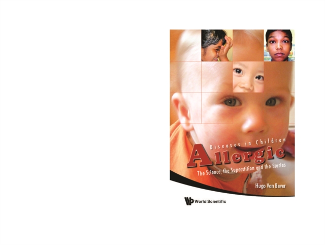 Allergic Diseases In Children: The Science, The Superstition And The Stories