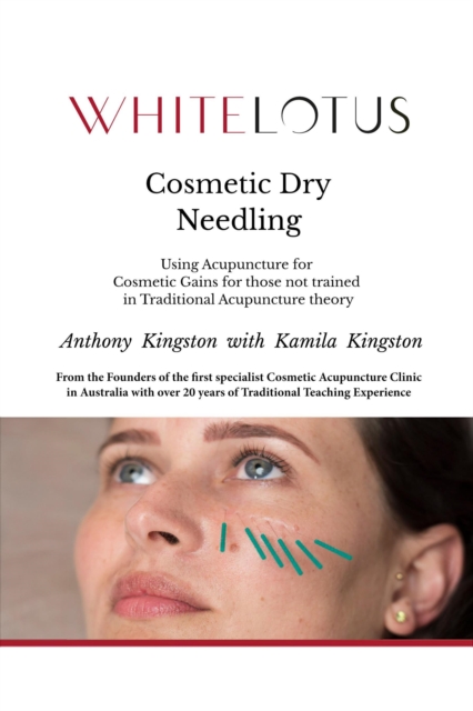 Cosmetic Dry Needling: Using Acupuncture for Cosmetic Gains for Those Not Trained in Traditional Acupuncture Theory