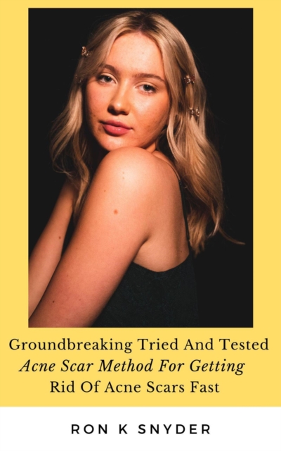 Groundbreaking Tried And Tested Acne Scar Method For Getting Rid Of Acne Scars Fast