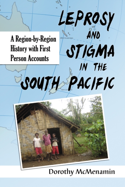 Leprosy and Stigma in the South Pacific