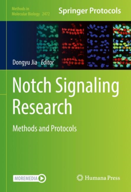 Notch Signaling Research